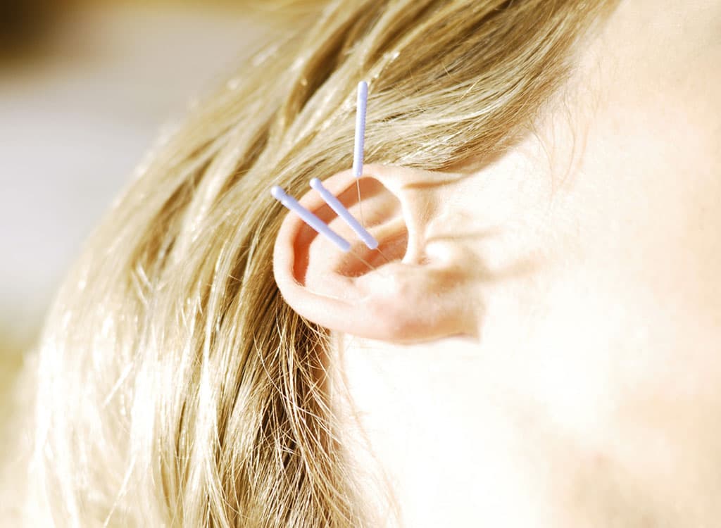 How Does Ear Acupuncture Help with Recovery?